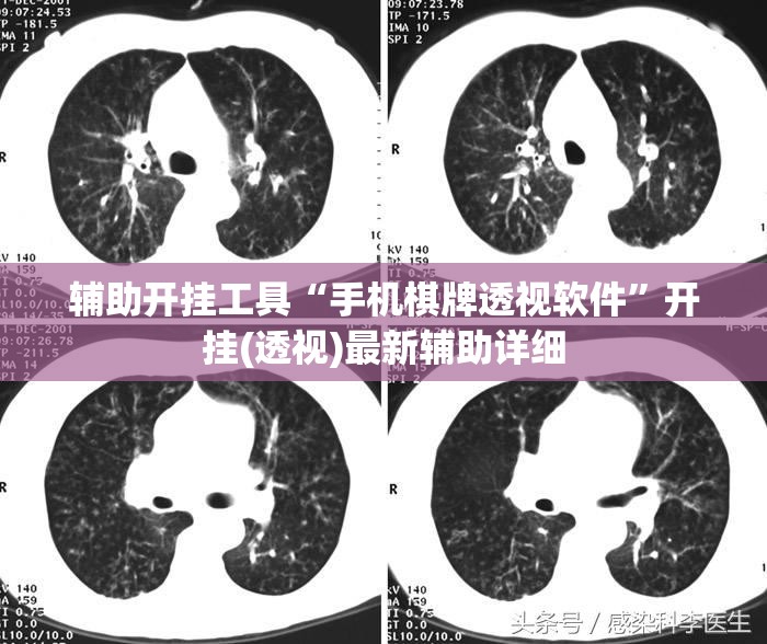 辅助开挂工具“手机棋牌透视软件”开挂(透视)最新辅助详细