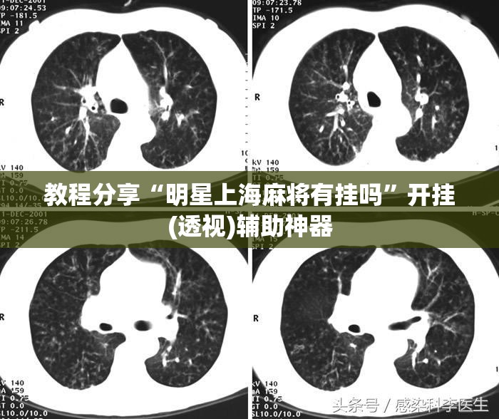 教程分享“明星上海麻将有挂吗	”开挂(透视)辅助神器